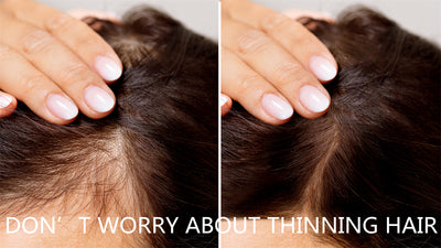 DON’T WORRY ABOUT THINNING HAIR