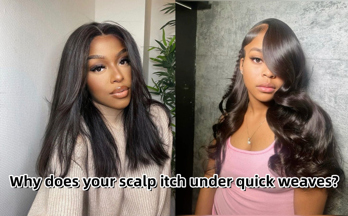 Why does your scalp itch under quick weaves?