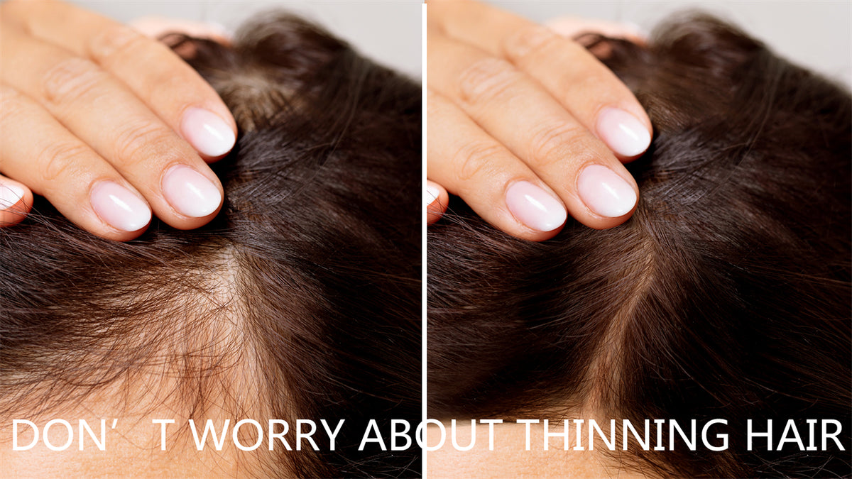 DON’T WORRY ABOUT THINNING HAIR